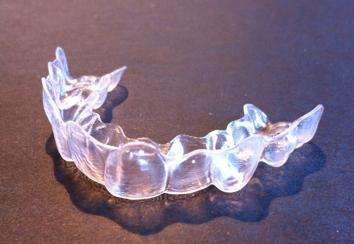 A clear aligner held up to the light